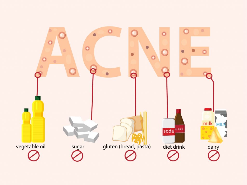 Why Do You Suddenly Get Acne in the Late 20s? - Voibon Blog