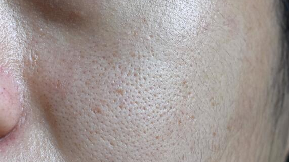 Dehydrated Pores