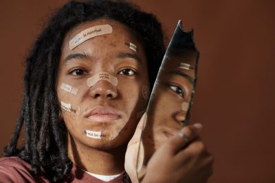 How Does Teen Acne Become Adult Acne?