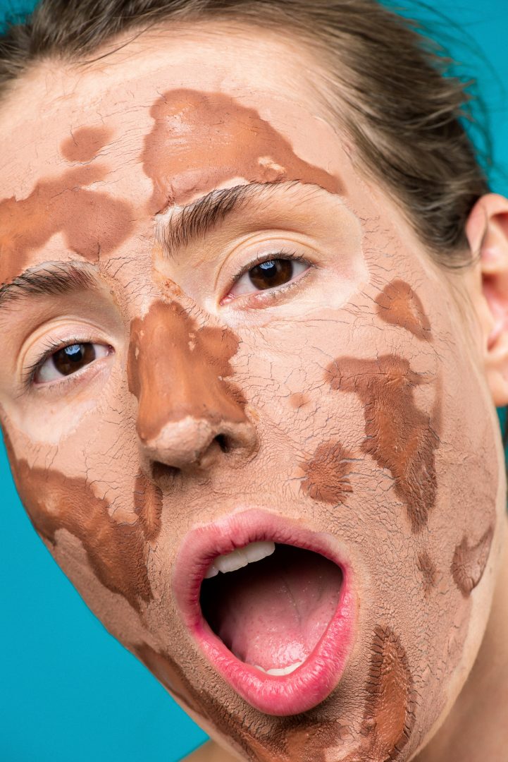 Oily Skin: Where Does The Oil Come From?