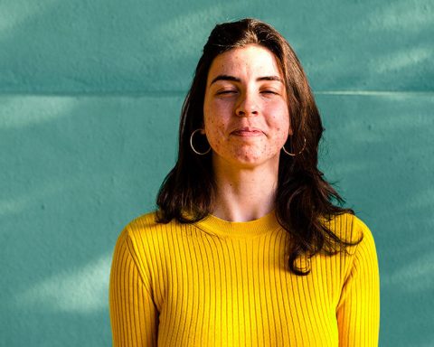 Why Do You Suddenly Get Acne In The Late 20s?