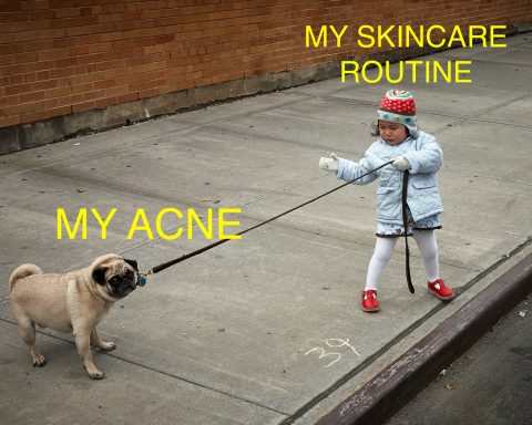 How To Treat Stubborn Adult Acne Without Seeing A Dermatologist？